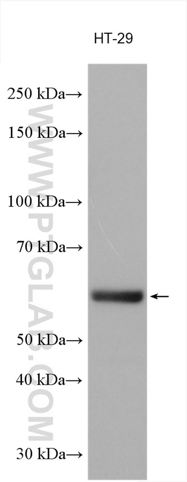 BAIAP2L2 Antibody in Western Blot (WB)