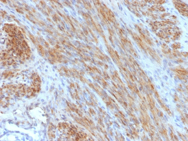 Desmin (Muscle Cell Marker) Antibody in Immunohistochemistry (Paraffin) (IHC (P))