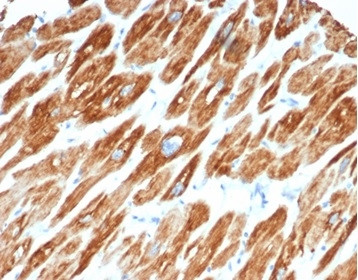 Desmin (Muscle Cell Marker) Antibody in Immunohistochemistry (Paraffin) (IHC (P))