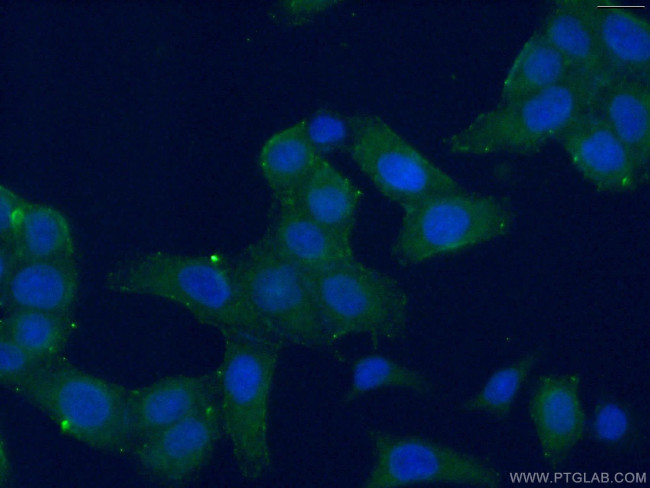 RPL15 Antibody in Immunocytochemistry (ICC/IF)