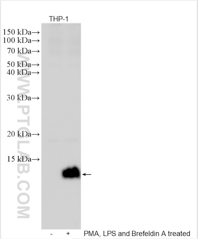MIP-1 Alpha/CCL3 Antibody in Western Blot (WB)