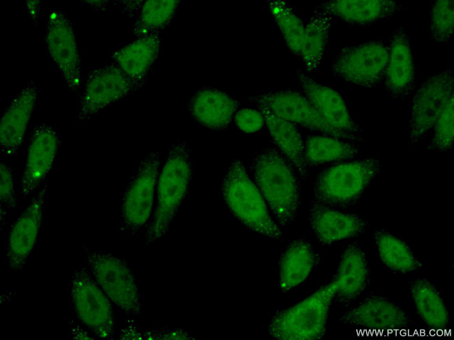 SPOP Antibody in Immunocytochemistry (ICC/IF)