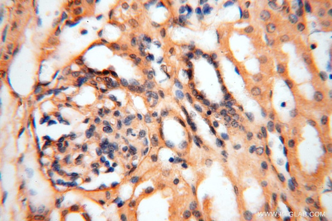 AGPAT6 Antibody in Immunohistochemistry (Paraffin) (IHC (P))