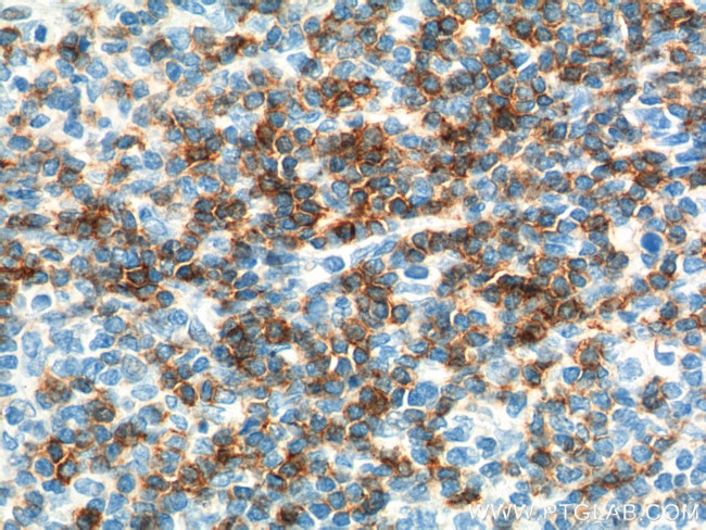 CD6 Antibody in Immunohistochemistry (Paraffin) (IHC (P))