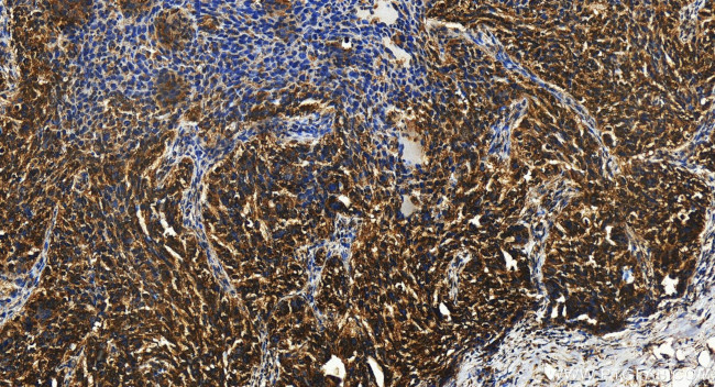 MRPL40 Antibody in Immunohistochemistry (Paraffin) (IHC (P))