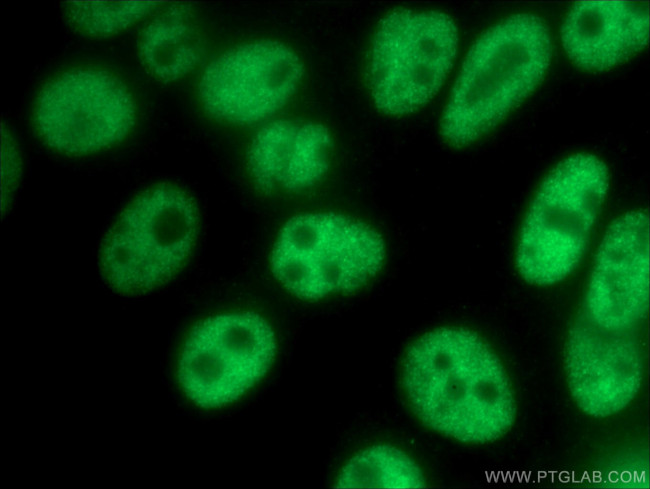 FOXP4 Antibody in Immunocytochemistry (ICC/IF)