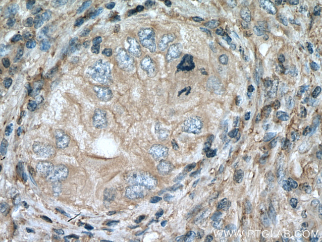 APOC1 Antibody in Immunohistochemistry (Paraffin) (IHC (P))