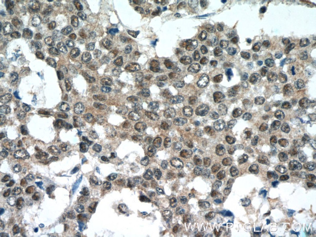 NEDD8 Antibody in Immunohistochemistry (Paraffin) (IHC (P))