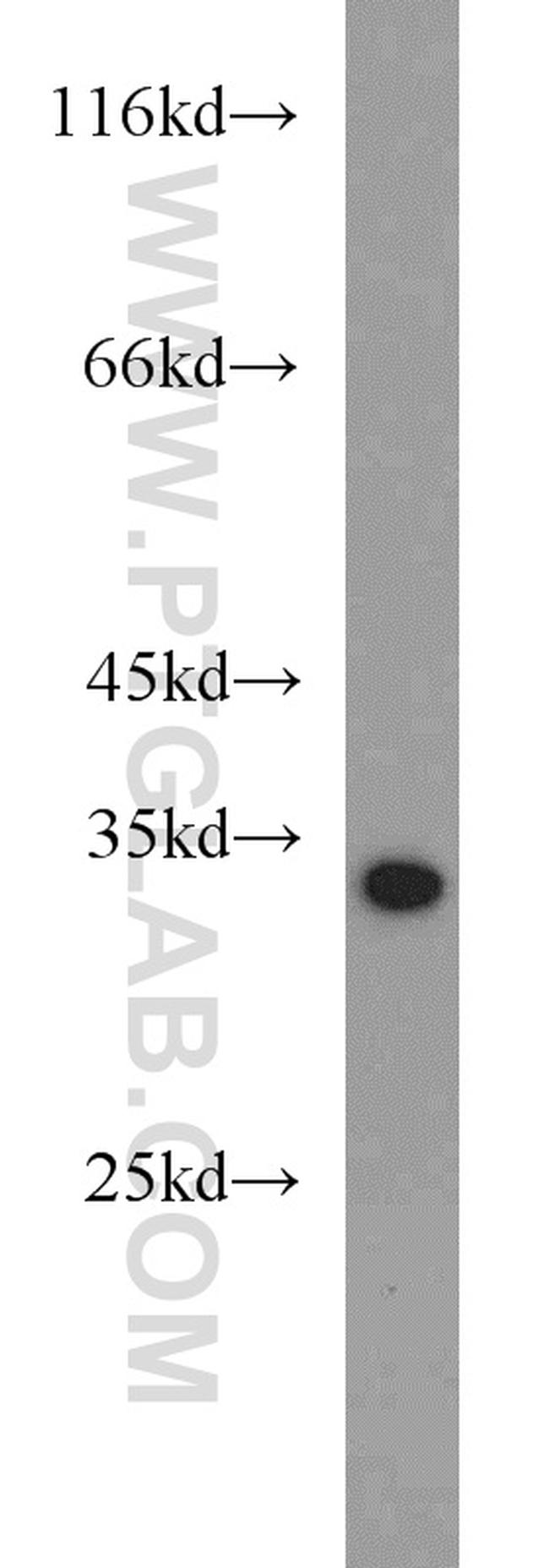 ACY3 Antibody in Western Blot (WB)