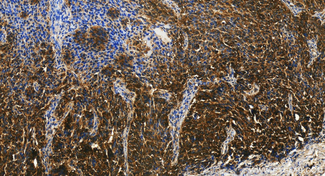 SNX24 Antibody in Immunohistochemistry (Paraffin) (IHC (P))