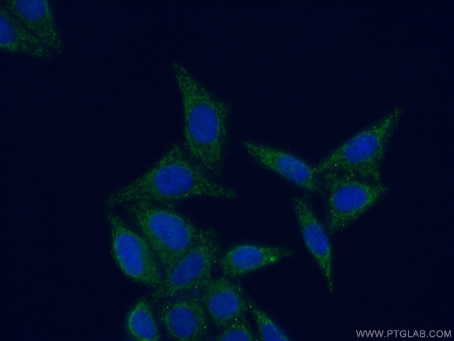 MRPL52 Antibody in Immunocytochemistry (ICC/IF)