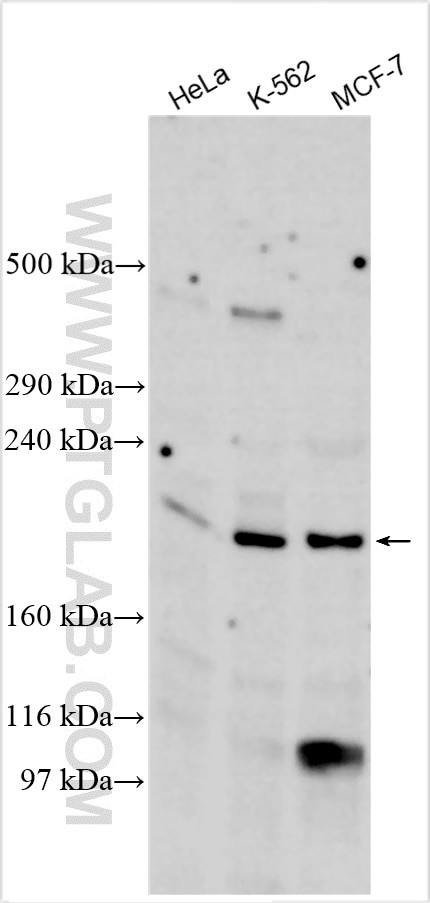 ASXL1 Antibody in Western Blot (WB)