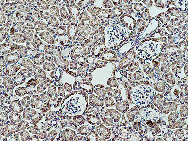 RPLP2 Antibody in Immunohistochemistry (Paraffin) (IHC (P))