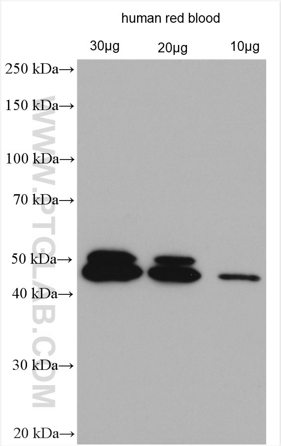 Dematin Antibody in Western Blot (WB)