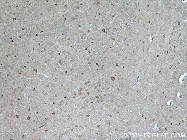 HSP20 Antibody in Immunohistochemistry (Paraffin) (IHC (P))