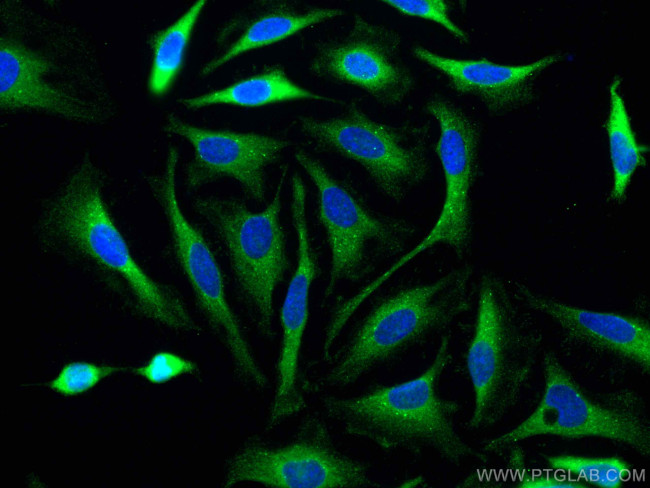 p130Cas Antibody in Immunocytochemistry (ICC/IF)