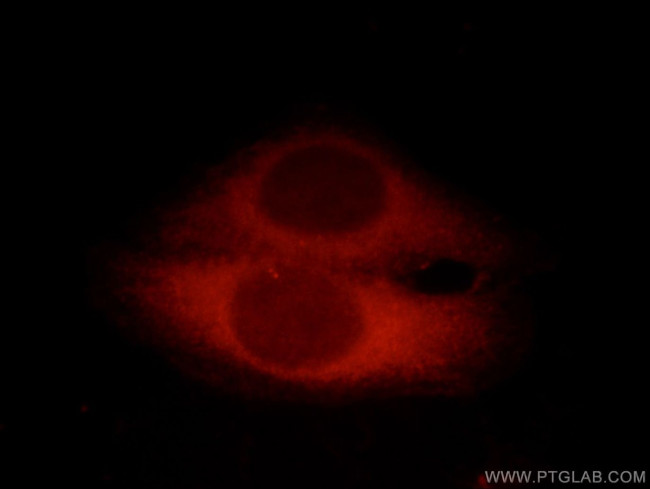 CC2D1A Antibody in Immunocytochemistry (ICC/IF)