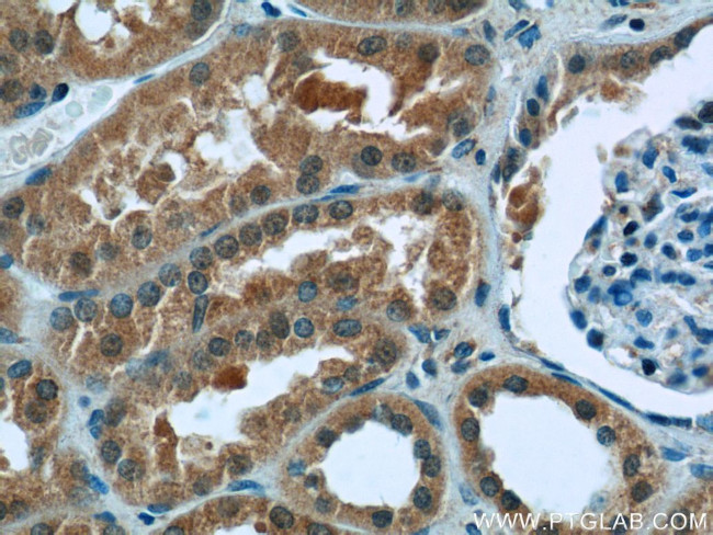 ZC3HAV1 Antibody in Immunohistochemistry (Paraffin) (IHC (P))