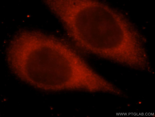 SPR Antibody in Immunocytochemistry (ICC/IF)
