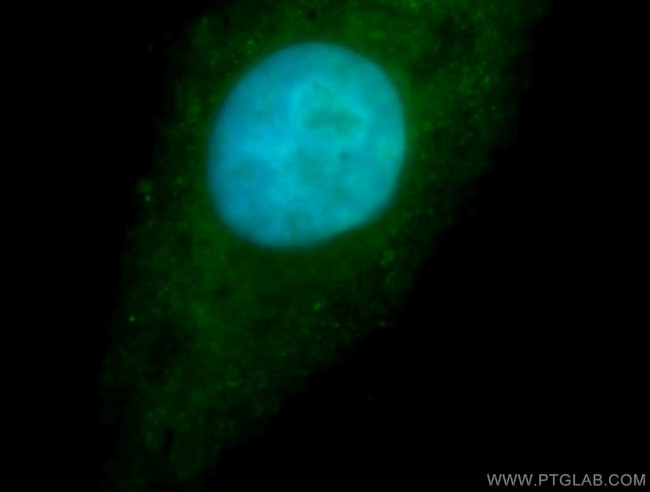RBM26 Antibody in Immunocytochemistry (ICC/IF)