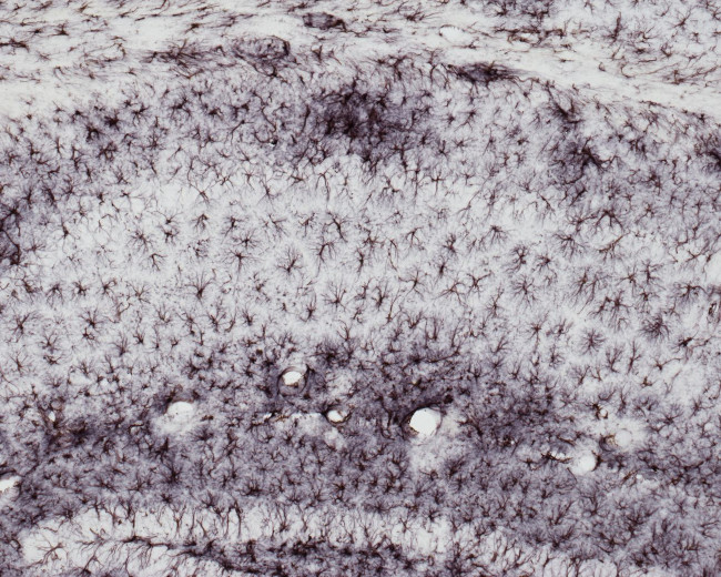 GFAP Antibody in Immunohistochemistry (Paraffin) (IHC (P))