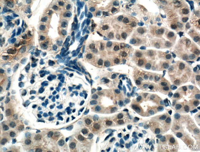 CNRIP1 Antibody in Immunohistochemistry (Paraffin) (IHC (P))