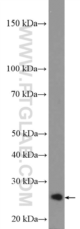 RP9 Antibody in Western Blot (WB)