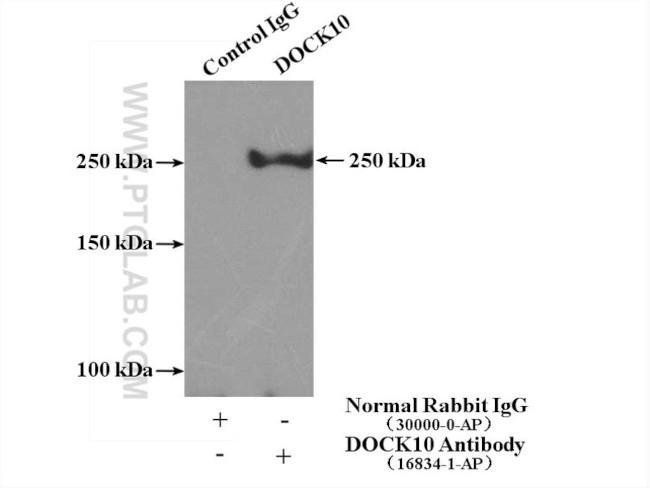 DOCK10 Antibody in Immunoprecipitation (IP)