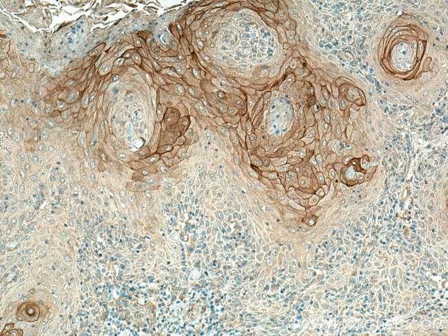 KRT80 Antibody in Immunohistochemistry (Paraffin) (IHC (P))