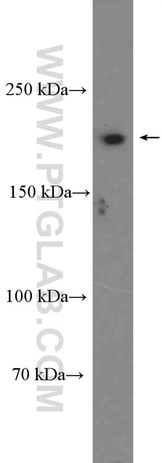 SETBP1 Antibody in Western Blot (WB)