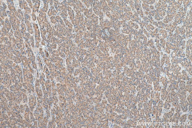 HEBP1 Antibody in Immunohistochemistry (Paraffin) (IHC (P))