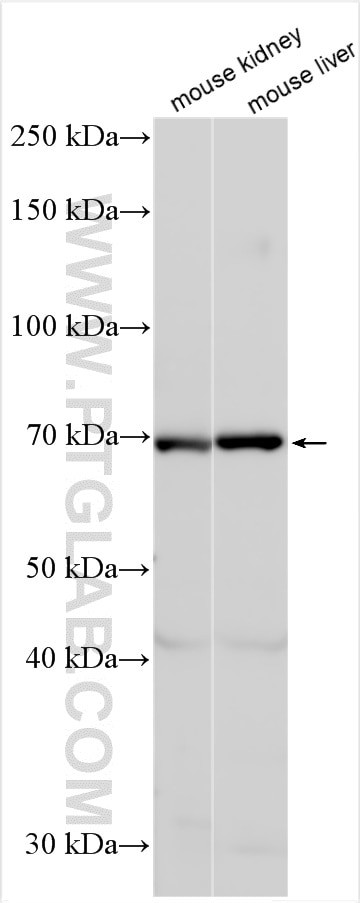 OAT3/SLC22A8 Antibody in Western Blot (WB)