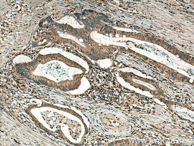 GPX8 Antibody in Immunohistochemistry (Paraffin) (IHC (P))