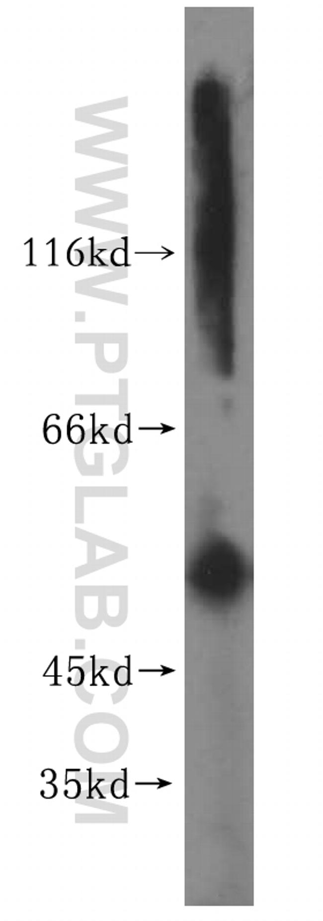 Cytokeratin 6A Antibody in Western Blot (WB)
