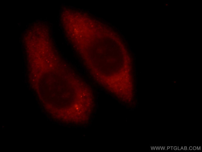 RAB3C Antibody in Immunocytochemistry (ICC/IF)