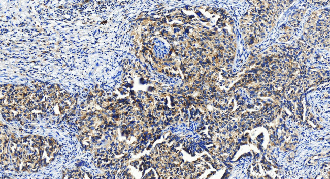 IFIH1 Antibody in Immunohistochemistry (Paraffin) (IHC (P))