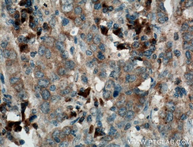 Pepsinogen II Antibody in Immunohistochemistry (Paraffin) (IHC (P))