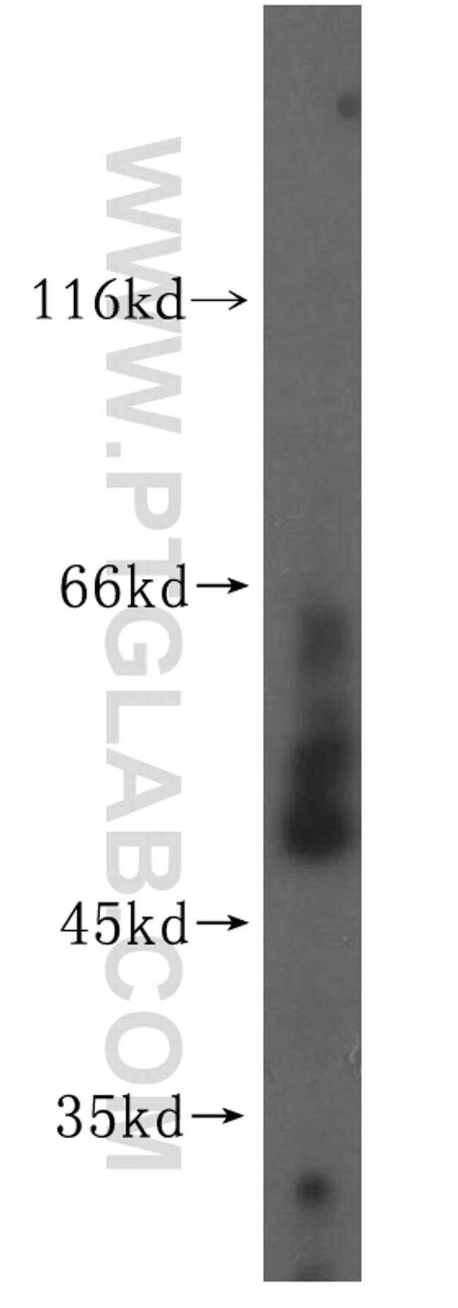 ZNHIT2 Antibody in Western Blot (WB)