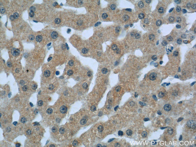 C1qC Antibody in Immunohistochemistry (Paraffin) (IHC (P))