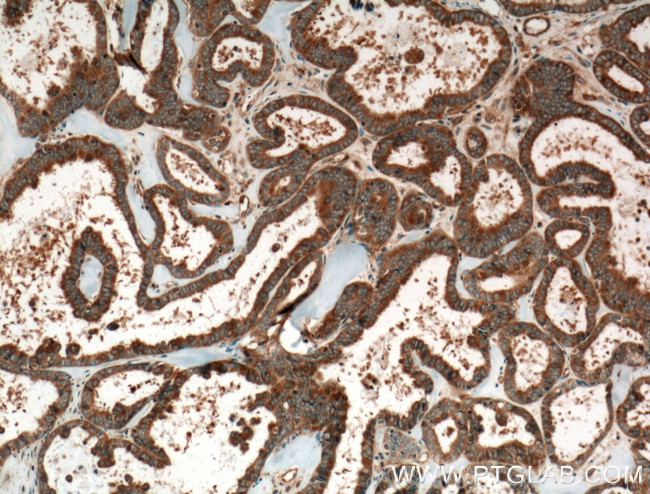 CRYZL1 Antibody in Immunohistochemistry (Paraffin) (IHC (P))
