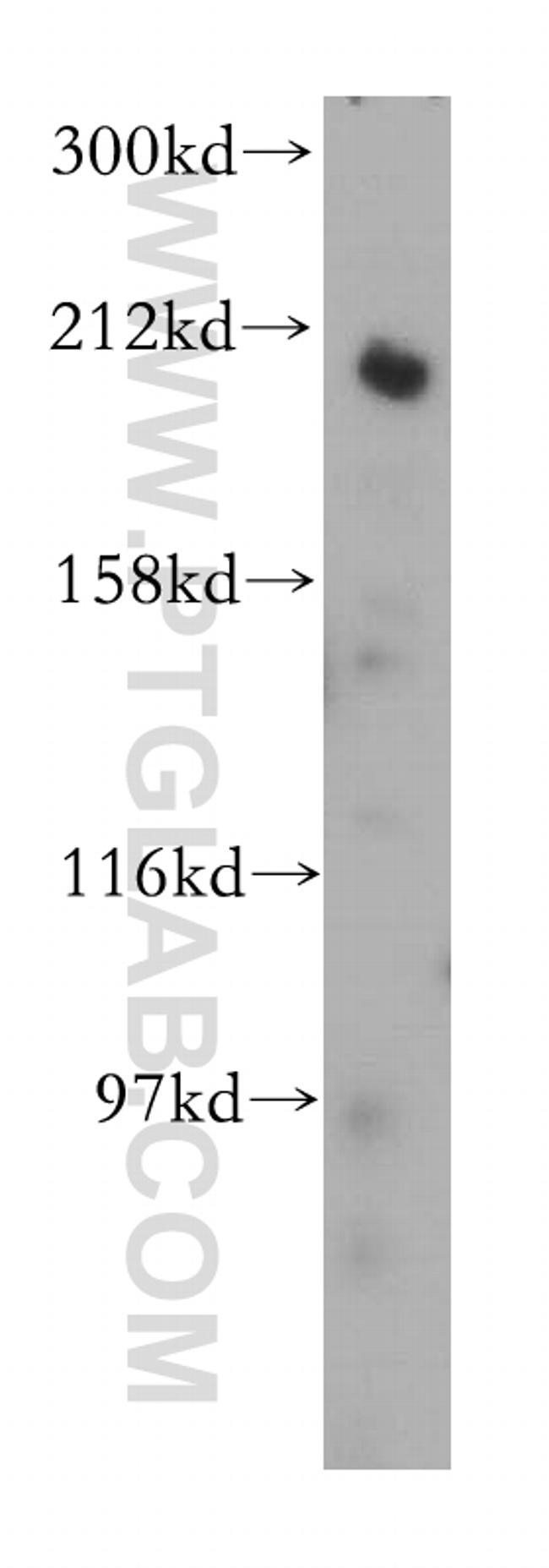 gp210 Antibody in Western Blot (WB)