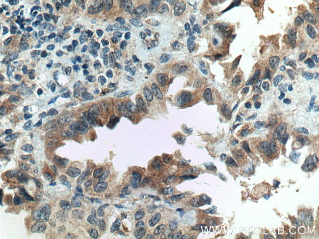 FAM156A Antibody in Immunohistochemistry (Paraffin) (IHC (P))