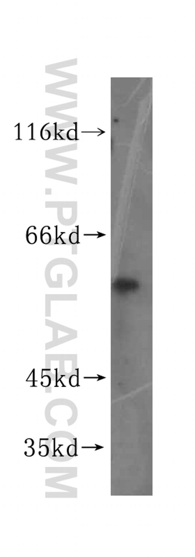 KLHDC4 Antibody in Western Blot (WB)