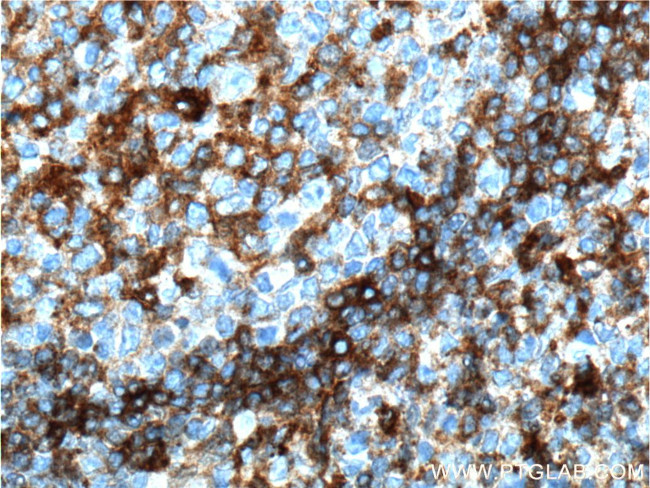HLA-DQA1 Antibody in Immunohistochemistry (Paraffin) (IHC (P))