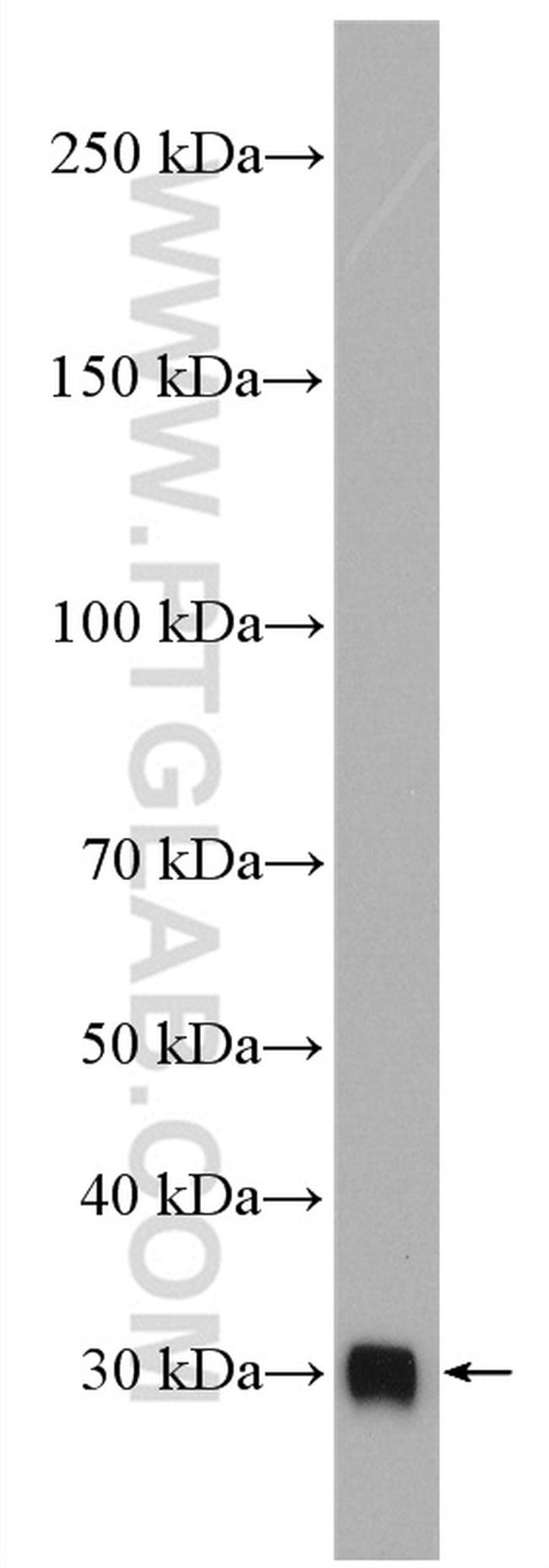 C1qB Antibody in Western Blot (WB)