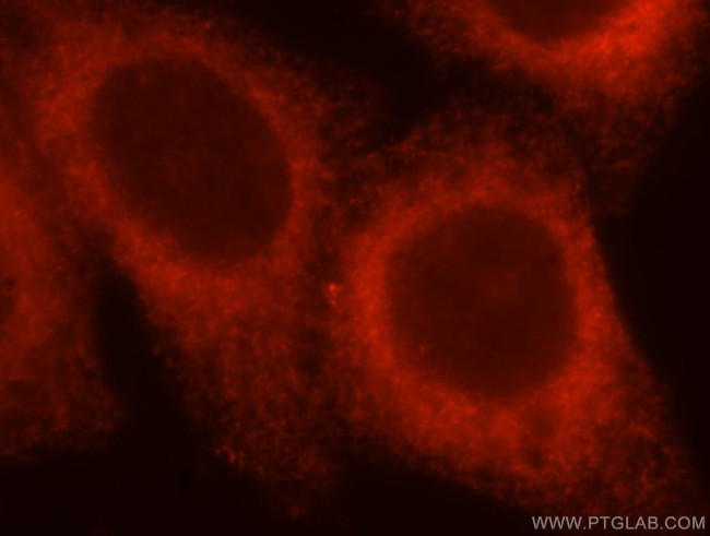 ATL3 Antibody in Immunocytochemistry (ICC/IF)