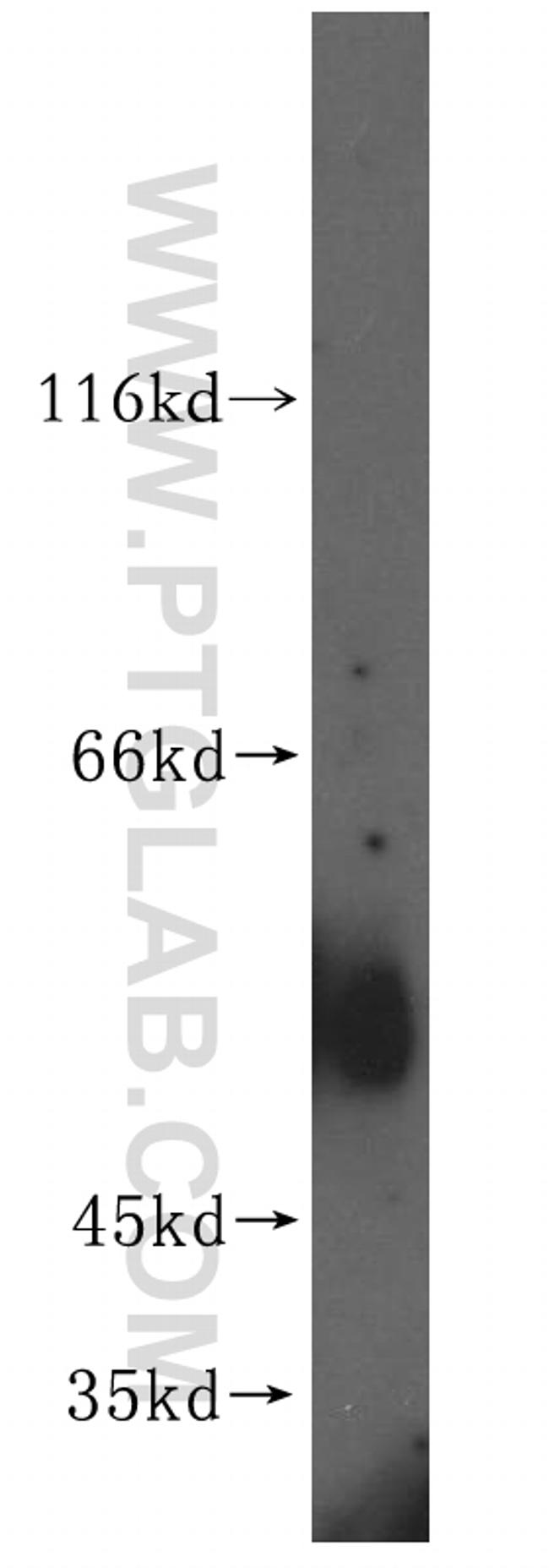 ATG4D Antibody in Western Blot (WB)