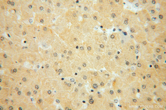 HSD17B7 Antibody in Immunohistochemistry (Paraffin) (IHC (P))