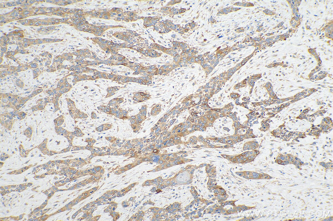Calcyphosine Antibody in Immunohistochemistry (Paraffin) (IHC (P))