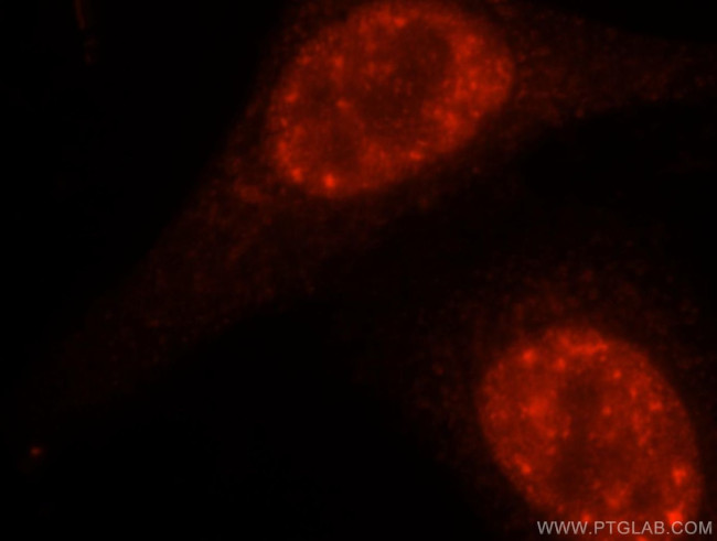 DDX46 Antibody in Immunocytochemistry (ICC/IF)